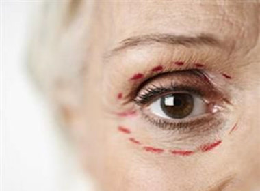 依雪眼部去皱有哪些方法?