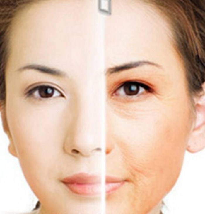 面部提升最好的方法