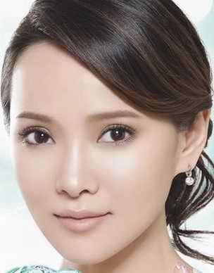 面部色斑严重怎么办