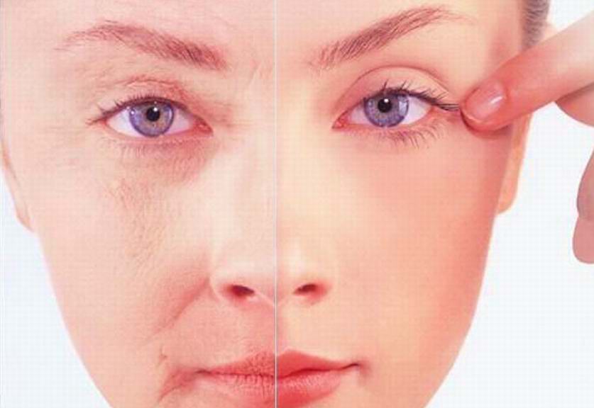 重庆面部除皱的价格