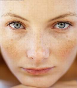 重庆祛斑最好的方法是什么?