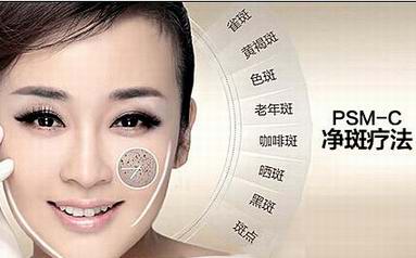 重庆去除雀斑最好的方法