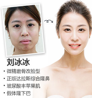 重庆华美整形美容医院_重庆整容医院_重庆最